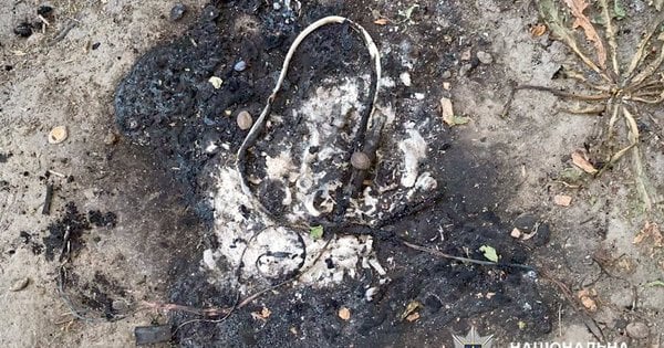 Вибух на Хмельниччині: 11-річний хлопчик постраждав від невідомого предмета.